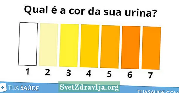 Chì pò significà u culore di l'urina (urina gialla, bianca, aranciu) - Salute