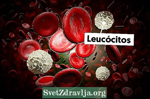 Cosa significa leucociti alti o bassi?