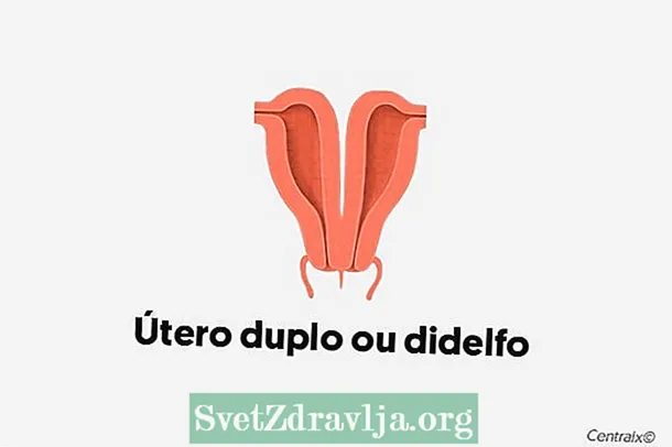 هڪ uterus didelfo ڇا هو