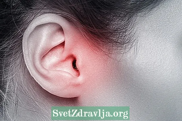 Inflamme ear: wichtichste oarsaken en wat te dwaan