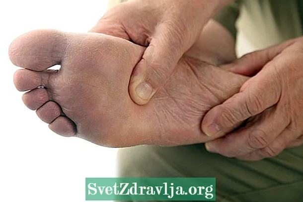 Diabéteszes láb: mi ez, tünetei és kezelése - Alkalmasság