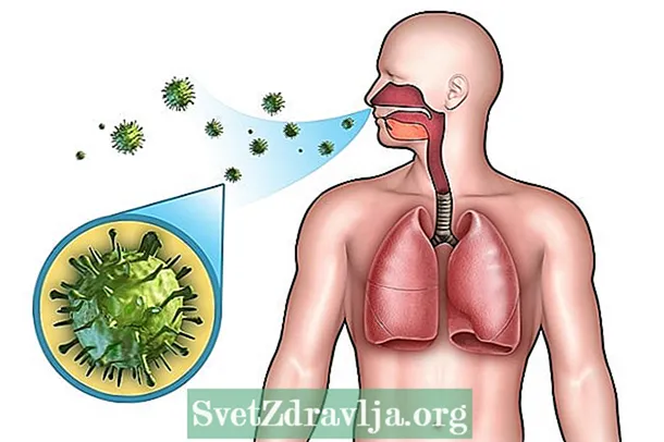 ප්‍රජා නියුමෝනියාව: එය කුමක්ද, රෝග ලක්ෂණ සහ ප්‍රතිකාර