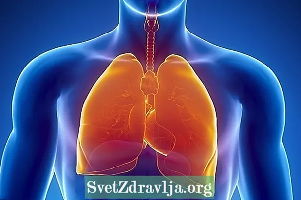 Upala pluća: što je to, vrste, simptomi i liječenje