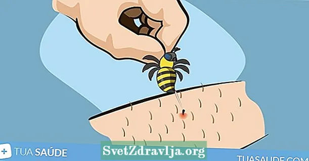 Earste help foar bijen of wespenstek