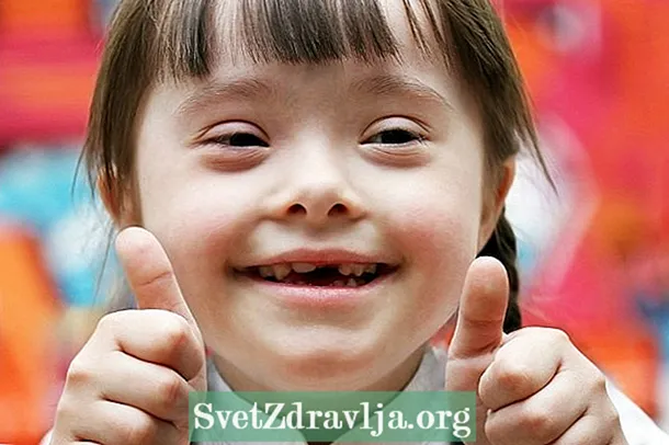 Zinthu zazikulu za Down syndrome