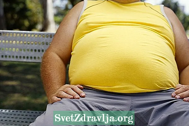 Hovedårsagerne til fedme og hvordan man kæmper