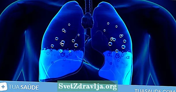 Vigtigste lungevand symptomer, årsager og hvordan man behandler