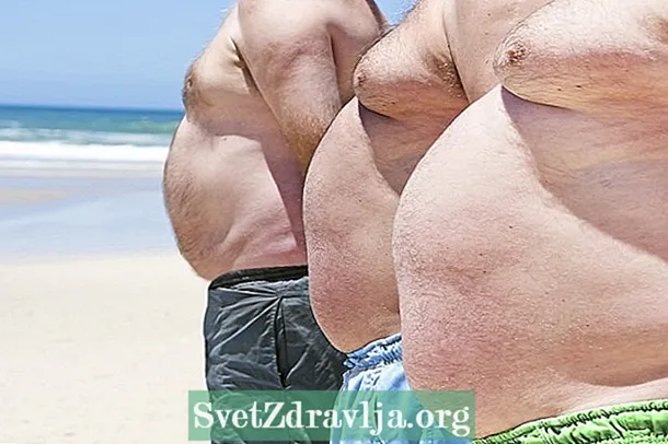 Основни видове затлъстяване и как да се идентифицират