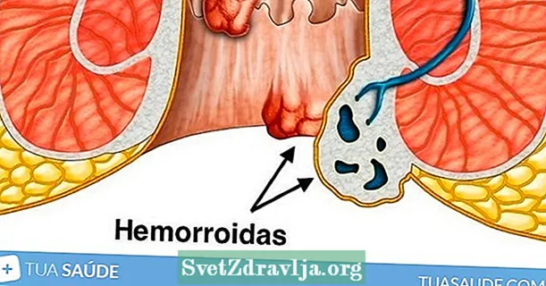 Hjemmemedisiner for hemoroider