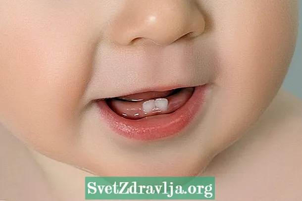 Средства для снятия боли при рождении зубов