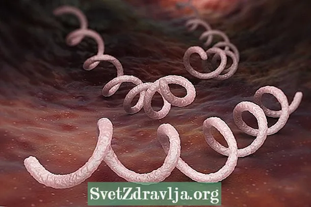 Lehen sifilisa: zer den, sintoma nagusiak eta tratamendua