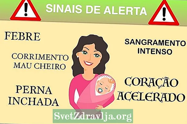 Opozorilni znaki po porodu - Fitnes