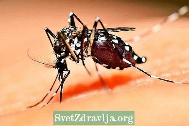 Zika birusak eragindako sintomak