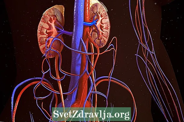 Izimpawu ze-Renal Tubular Acidosis nokuthi ukwelashwa kwenziwa kanjani