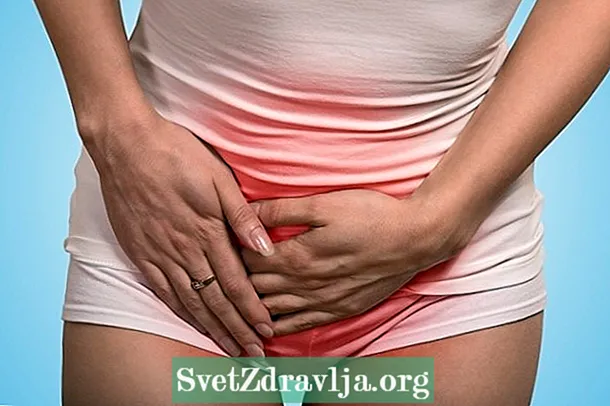 자궁 경부염 증상 및 주요 원인
