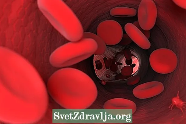 Zviratidzo zvehemophilia, sei kuongororwa uye kusahadzika kunowanzoitika