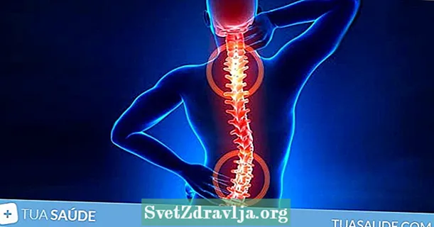 腰椎、頸椎、胸椎の椎間板ヘルニアの症状とその予防方法