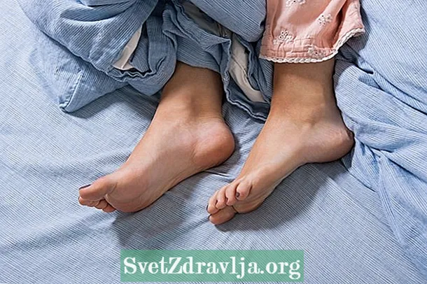 Синдром неспокійних ніг: що це, симптоми і як лікувати