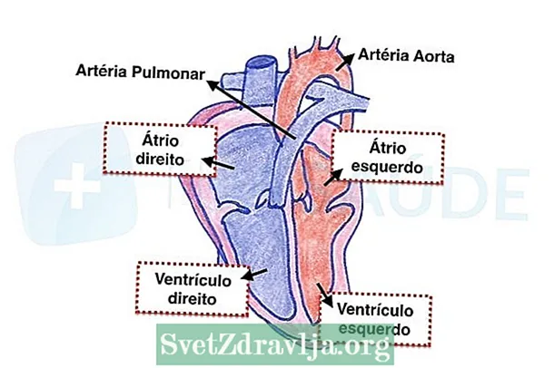 Tachycardie ventriculaire: qu'est-ce que c'est, symptômes et traitement