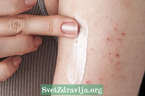 Tarfic: salva för atopisk dermatit - Kondition