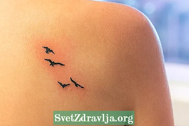 Φλεγμονή τατουάζ: γιατί συμβαίνει και τι πρέπει να κάνετε