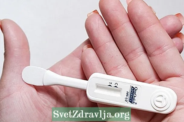 Un test rápido identifica o VIH en saliva e sangue - Saúde
