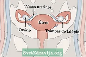 Transplantadh uterus: dè a th ’ann, mar a tha e air a dhèanamh agus cunnartan a dh’ fhaodadh a bhith ann