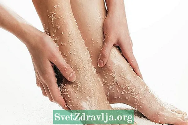 Domaći tretman za uklanjanje žuljeva na stopalima