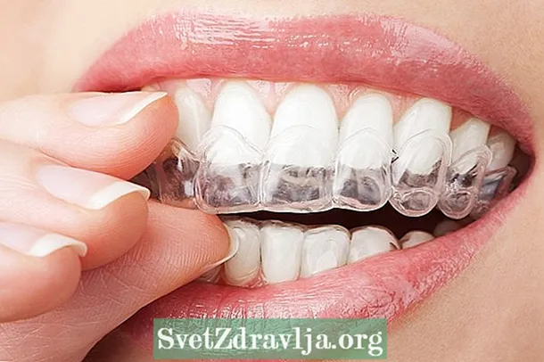Tuisbehandeling om vlekke van tande te verwyder