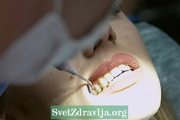 Zdravljenje raka ust