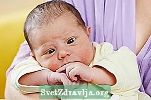 Liječenje strabizma kod novorođenčadi