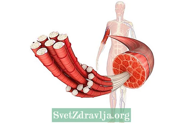 Fitsaboana ny myopathie nemaline - Fahasalamana