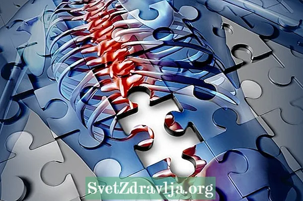 Traumatismul coloanei vertebrale: ce este, de ce se întâmplă și tratament