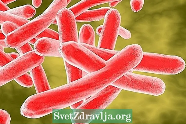 Да ли се туберкулоза може излечити?
