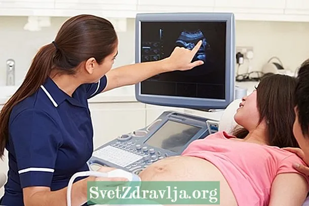 Morfološki ultrazvuk: što je to, čemu služi i kada to učiniti - Sposobnost