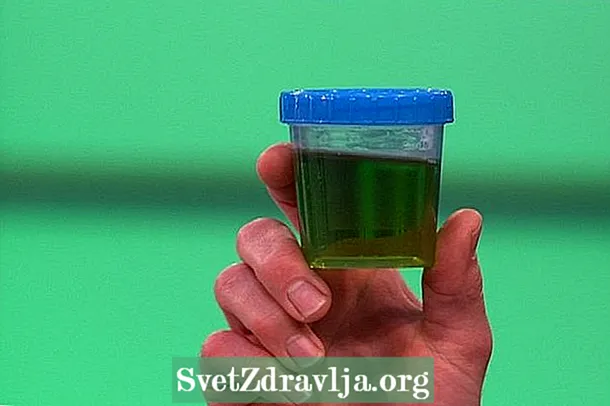 Grønn urin: 4 hovedårsaker og hva du skal gjøre
