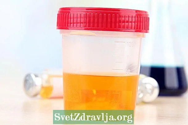Urobilinogène dans l'urine: ce que cela peut être et que faire