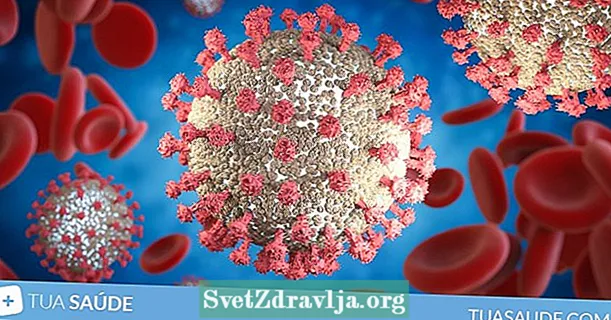 Virosis: nedir, ana semptomlar ve tedavi