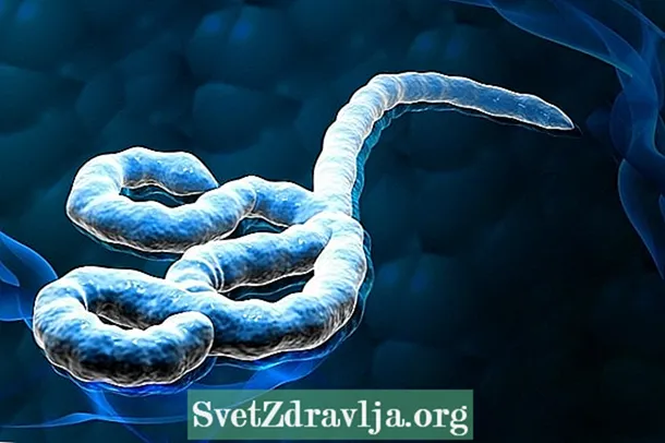 Вирус ебола: како настанал, видови и како да се заштитите