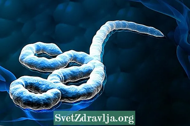 Virus Ebola: cara nggawe, jinis lan cara nglindhungi awak dhewe