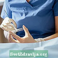 Pag-screen ng Cervical Cancer