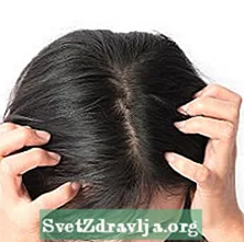 Kepek, Beşik Başlığı ve Diğer Saç Derisi Koşulları - Ilaç