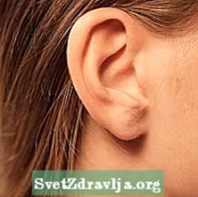 Поремећаји слуха и глувоћа