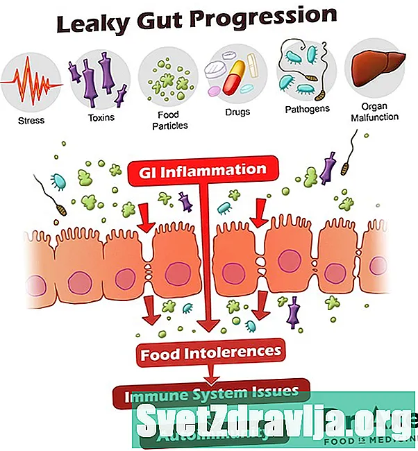 Leaky Gut Sendromu Gerçek Bir Durum mu? Tarafsız Bir Bakış - Beslenme